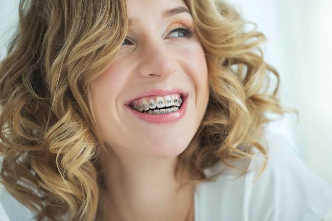 Albany Braces
